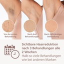 Philips IPL-Haarentferner Lumea S9900 BRI953/02, 450.000 Lichtimpulse, Kabellos, 2 SkinAI Funktionen